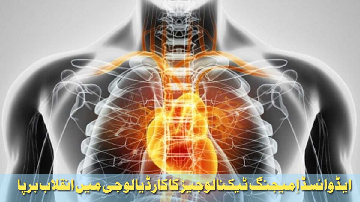 advance imaging techniques cardiology